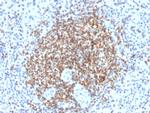 Bcl-2 Antibody in Immunohistochemistry (Paraffin) (IHC (P))