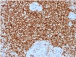 Bcl-2 Antibody in Immunohistochemistry (Paraffin) (IHC (P))