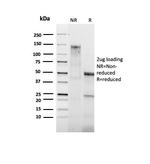 Bcl-2 Antibody in SDS-PAGE (SDS-PAGE)