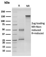 RET Proto-oncogene Antibody in SDS-PAGE (SDS-PAGE)