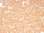 RET Proto-oncogene Antibody in Immunohistochemistry (Paraffin) (IHC (P))