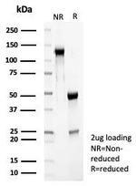 RET Proto-oncogene Antibody in Immunohistochemistry (Paraffin) (IHC (P))