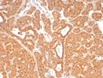 RET Proto-oncogene Antibody in Immunohistochemistry (Paraffin) (IHC (P))