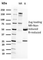 RET Proto-oncogene Antibody in SDS-PAGE (SDS-PAGE)