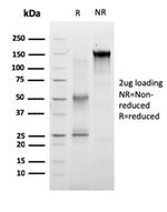 RET Proto-oncogene Antibody in SDS-PAGE (SDS-PAGE)