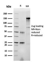 RET Proto-oncogene Antibody in SDS-PAGE (SDS-PAGE)