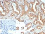 RET Proto-oncogene Antibody in Immunohistochemistry (Paraffin) (IHC (P))