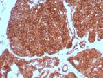 RET Proto-oncogene Antibody in Immunohistochemistry (Paraffin) (IHC (P))