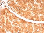 RET Proto-oncogene Antibody in Immunohistochemistry (Paraffin) (IHC (P))