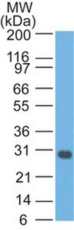 Bcl-X (Apoptosis Marker) Antibody in Western Blot (WB)