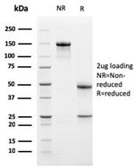 Bcl-X (Apoptosis Marker) Antibody in SDS-PAGE (SDS-PAGE)