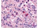 Artemis Antibody in Immunohistochemistry (Paraffin) (IHC (P))