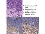 P38 Antibody in Immunohistochemistry (IHC)