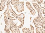 Mash1/Ascl1 Antibody in Immunohistochemistry (IHC)