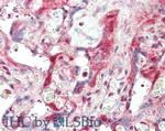 Laminin Antibody in Immunohistochemistry (Paraffin) (IHC (P))