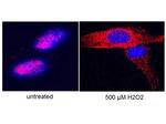 Telomerase catalytic subunit Antibody in Immunocytochemistry (ICC/IF)