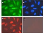 Telomerase catalytic subunit Antibody in Immunocytochemistry (ICC/IF)