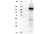 Telomerase catalytic subunit Antibody in Western Blot (WB)