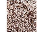 Phospho-AKT (Thr308) Antibody in Immunohistochemistry (IHC)