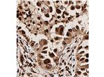 Phospho-AKT (Thr308) Antibody in Immunohistochemistry (IHC)