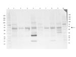 Phospho-AKT (Thr308) Antibody in Western Blot (WB)