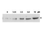 Phospho-CHK2 (Thr68) Antibody in Western Blot (WB)