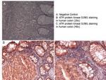 Phospho-ATM Protein Kinase (Ser1981) Antibody in Immunohistochemistry (Paraffin) (IHC (P))