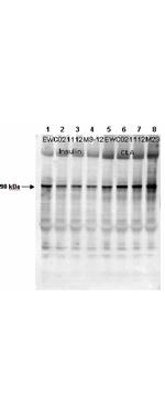 Phospho-Glycogen Synthase 1 (Ser641) Antibody in Western Blot (WB)