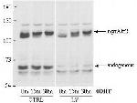 AKT2 Antibody in Western Blot (WB)