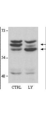 AKT2 Antibody in Western Blot (WB)