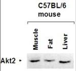 AKT2 Antibody in Western Blot (WB)