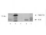 PNK Antibody in Western Blot (WB)