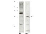 HUS1B Antibody in Western Blot (WB)