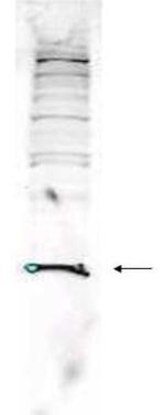 PARK-7 Antibody in Western Blot (WB)