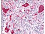 ROBO-1 Antibody in Immunohistochemistry (Paraffin) (IHC (P))