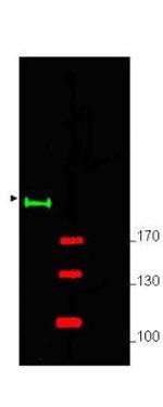 Gli2 Antibody in Western Blot (WB)