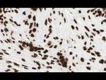 GLI2 Antibody in Immunohistochemistry (Paraffin) (IHC (P))