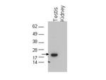 Glutathione Peroxidase 4 Antibody in Western Blot (WB)