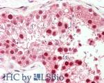 PIN1 Antibody in Immunohistochemistry (Paraffin) (IHC (P))