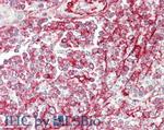 NCOA3 Antibody in Immunohistochemistry (Paraffin) (IHC (P))