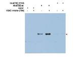 ATDC Ac-K116 Antibody in Western Blot (WB)