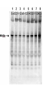 Phospho-Muscle Glycogen Synthase (Ser641) Antibody in Western Blot (WB)