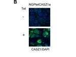 CASZ1 Antibody in Immunohistochemistry (IHC)