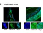 CASZ1 Antibody in Immunohistochemistry (IHC)