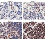 CASZ1 Antibody in Immunohistochemistry (IHC)