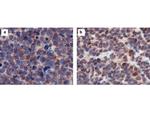 CASZ1 Antibody in Immunohistochemistry (IHC)