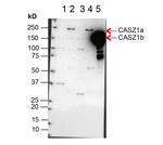 CASZ1 Antibody in Western Blot (WB)