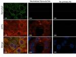 Sprouty-2 Antibody in Immunohistochemistry (Paraffin) (IHC (P))