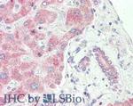 Sprouty-2 Antibody in Immunohistochemistry (Paraffin) (IHC (P))