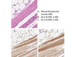 ZO-1 Antibody in Immunohistochemistry (Paraffin) (IHC (P))